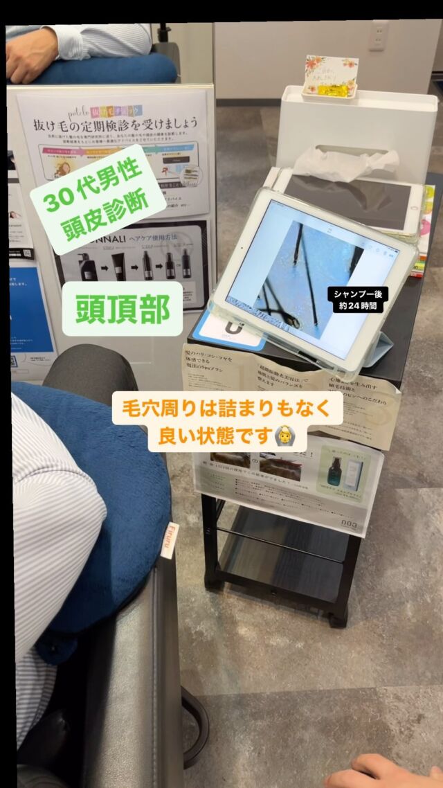 30代男性頭皮診断
#美容 #美容室 #美容師 #美容好きな人と繋がりたい #美容師さんと繋がりたい  #幸せ  #シャンプー  #出張  #頭皮ケア #ヘッドスパ #ヘッドスパサロン #エイジングケア #保湿 #保湿ケア #紫外線対策  #生活 #マッサージ #福井美容室#育毛#発毛#脱毛#毛髪診断士
#シャンプートレーナー#シャンプートレーナー山崎＃ドライヘッド＃福井ヘッドスパ#geluk