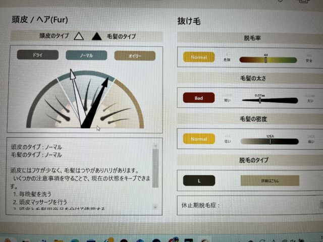 30代男性/日本唯一パーソナル頭皮診断

全体に良い状態にいらっしゃいます✨
髪の毛の太さは平均値よりも少し細めですが、生まれ持った太さがありますので、しっかり維持をして頂けると良いと思います🙆

頭皮が変われば髪の毛も変わる✨
髪Labo gelukではパーソナルな頭皮ケア、ヘアケア、生活習慣、シャンプーなりますが
やり方をお伝えしております！
毛髪診断士、毛髪技能士としても活動しております✨

必ずしも何かものを使わないといけないわけではなく、生活習慣、食事等それぞれが出来る範囲で出来る事を実践して頂いて、少しでも髪の毛、頭皮が良くなって頂き、幸せを感じて頂けたらと思っております🙇😊

DMでのご質問も受け付けております🙋
(例)
・フケが出る
・頭皮がかゆい
・髪が細くなってきた
・どんなシャンプーが良いのか？
・抜け毛が増えてきた
・髪を増やしていきたい
等・・・

どんな事でも大丈夫ですので、気になる事等ありましたらどうぞお気軽に何度もお申し付け下さい🙇😊

そして、出張サービスもしておりますので、
自店舗にも頭皮診断を入れて見たい美容室や美容関係の方々✨

美容以外でも、福井市内のBAR、ネイルサロン様にて出張頭皮診断ドライヘッドスパを行っておりますので、
ご興味のある会社様などもお問い合わせ受け付けております✨

どうぞ参考にして頂けますと幸いです✨

#geluk#毛髪診断士#頭皮診断#頭皮改善#白髪#毛髪技能士#福井美容室　#福井ヘッドスパ　#シャンプー　#エイジングケア　#アンチエイジング#山﨑彰悟　#geluk  #髪labogeluk #出張サービス　#出張　#出張頭皮診断　#出張ヘッドスパ　#髪質改善　#毛髪改善　#頭皮環境改善　#紫外線　#食生活　#食事　#生活習慣 #運動　#パーソナル頭皮診断#ヘアケア#頭皮ケア #抜け毛 #髪の毛